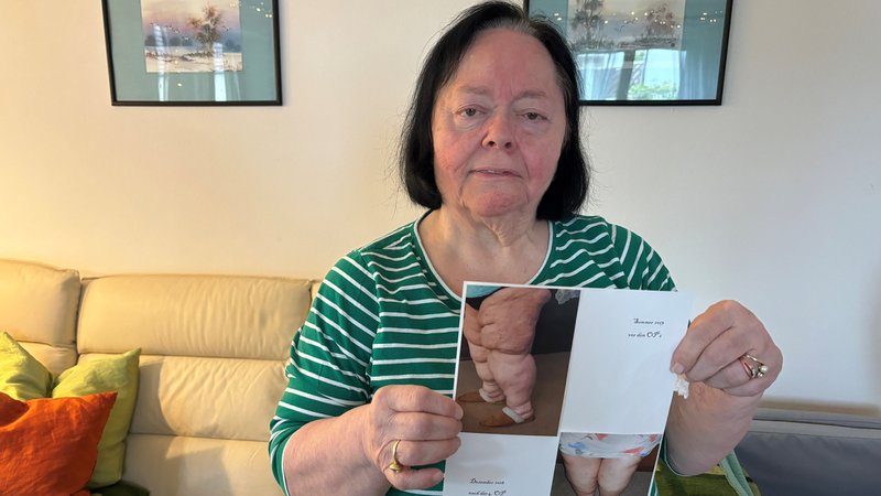 Marieluise Biesenbach sitzt auf einem Sofa und zeigt Bilder ihrer Beine vor den Operationen. | Bild: BR, Judith Zacher Marieluise Biesenbach sitzt auf einem Sofa und zeigt Bilder ihrer Beine vor den Operationen.