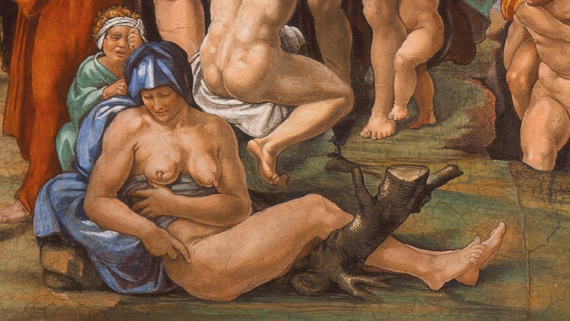 Ausschnitt aus Michelangelos Fresko "Die Sintflut". Abgebildet ist eine Frau mit einem Brustkrebs-Geschwulst.