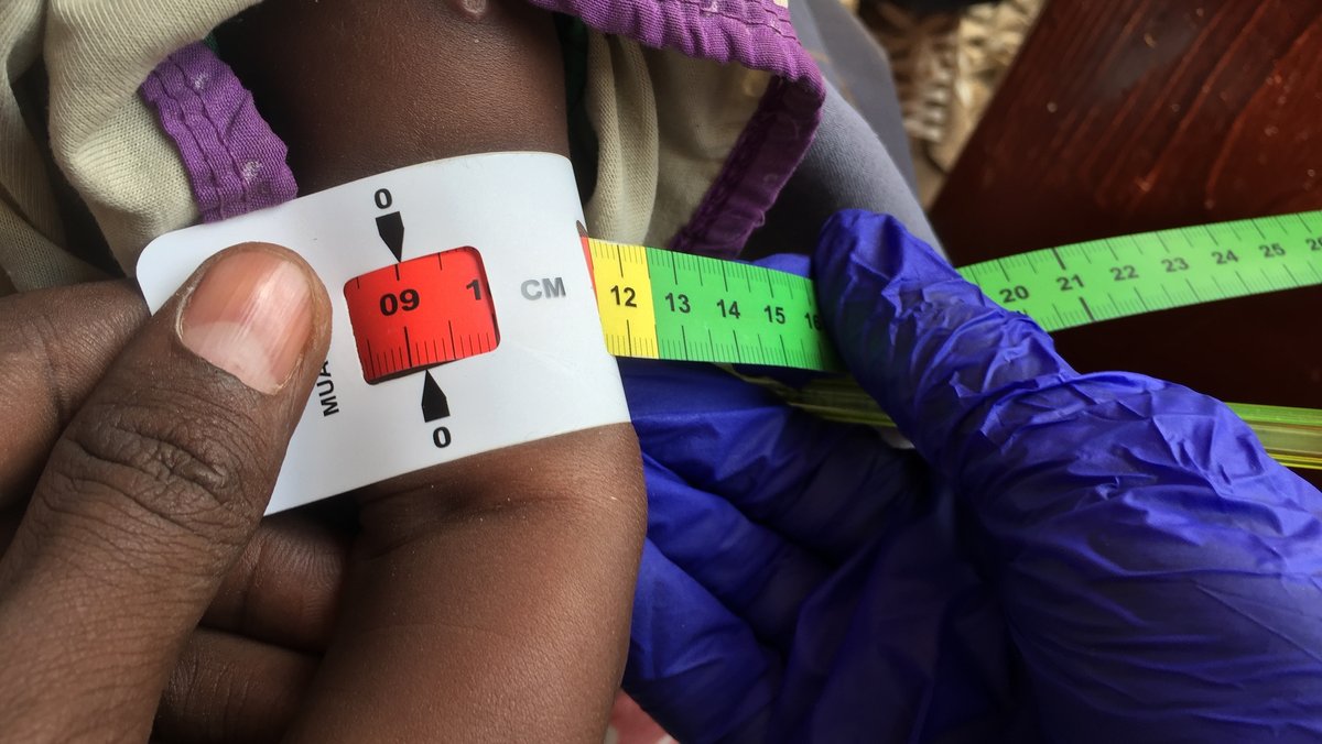Archivbild: Ein Arzt misst den Armumfang eines somalischen Babys in einer Klinik in Baidoa. 