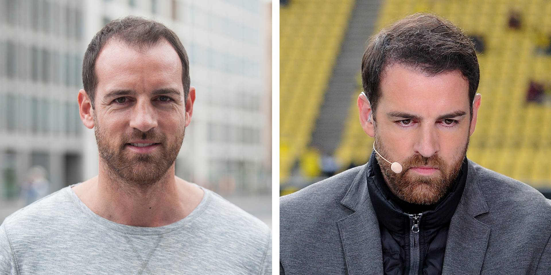 Christoph Metzelder Hat Jetzt Volleres Haar Haartransplantation Diese Promis Haben Die Frisur Getuned Bayern 3