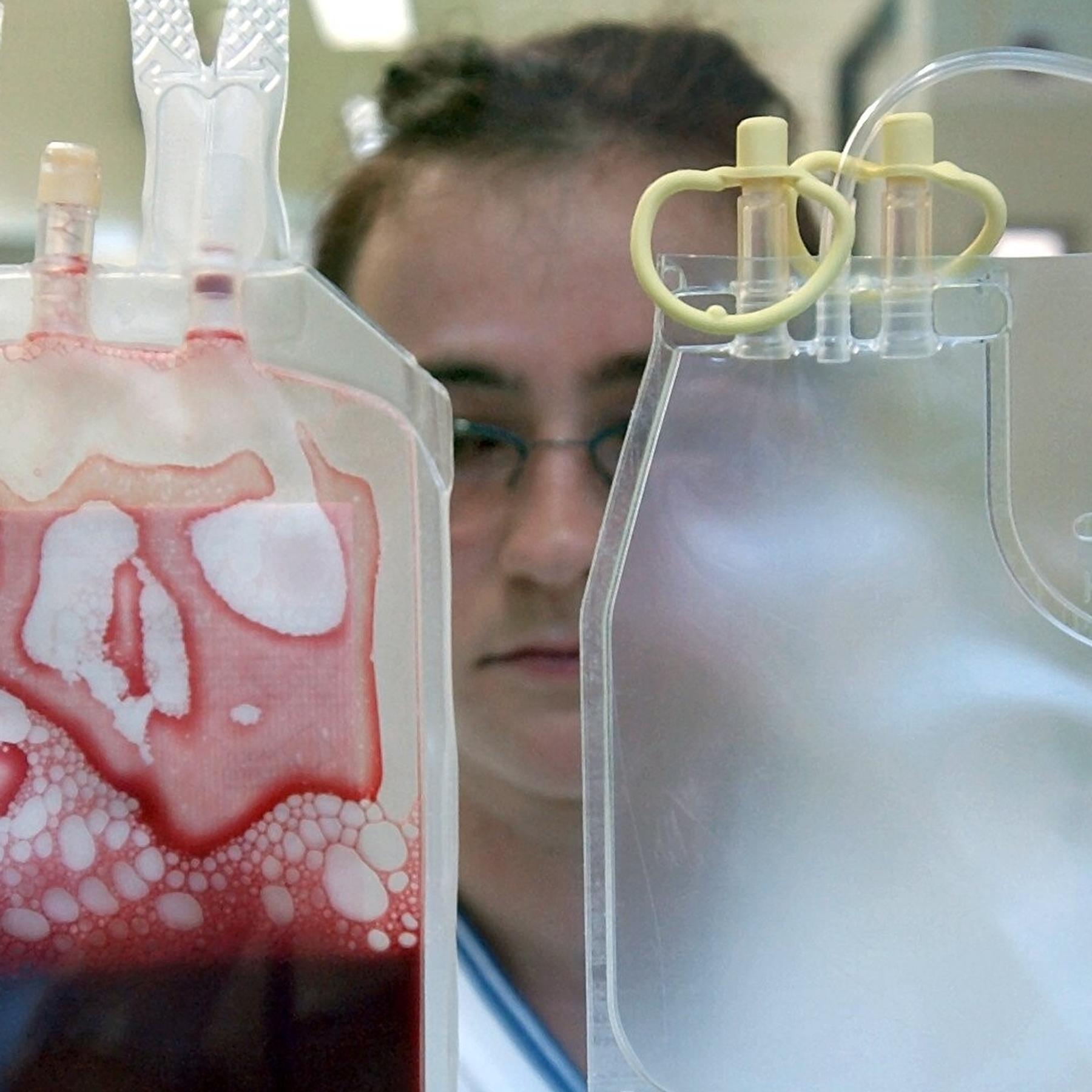 Stammzelltransplantation – So macht Nobelpreisforschung Leukämie-Therapien sicherer