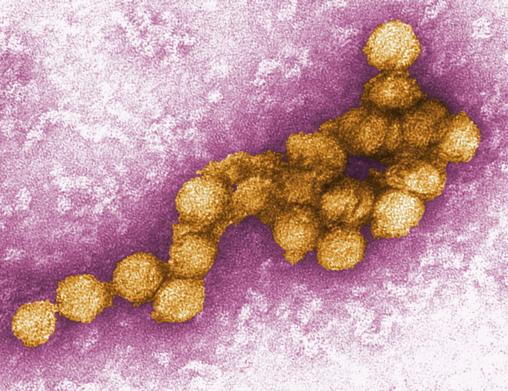 Elektronenmikroskopische Aufnahme des West-Nil-Virus