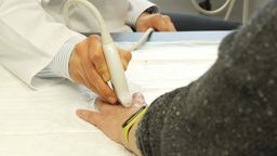 Ein Arzt geht mit einem Behandlungsgerät über die geschwollene Hand einer Patientin. | Bild:BR24/Frank Strerath