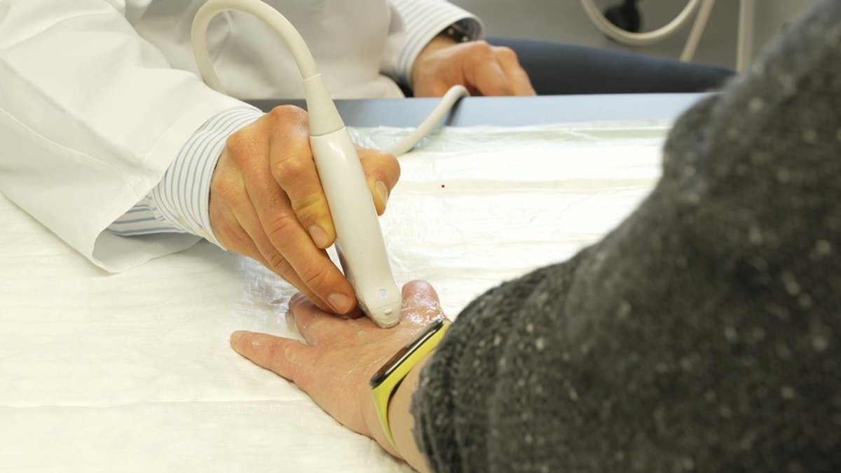 Ein Arzt geht mit einem Behandlungsgerät über die geschwollene Hand einer Patientin.