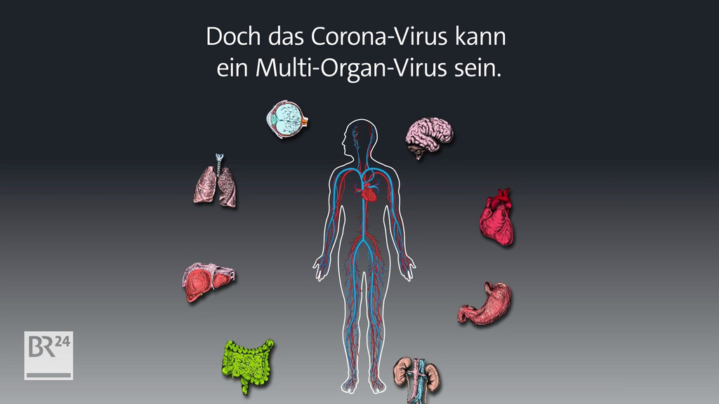 Das Coronavirus führt nicht nur zu schweren Lungenentzündungen, sondern kann auch andere Organe im Körper schwer schädigen | Bild: BR Das Coronavirus führt nicht nur zu schweren Lungenentzündungen, sondern kann auch andere Organe im Körper schwer schädigen