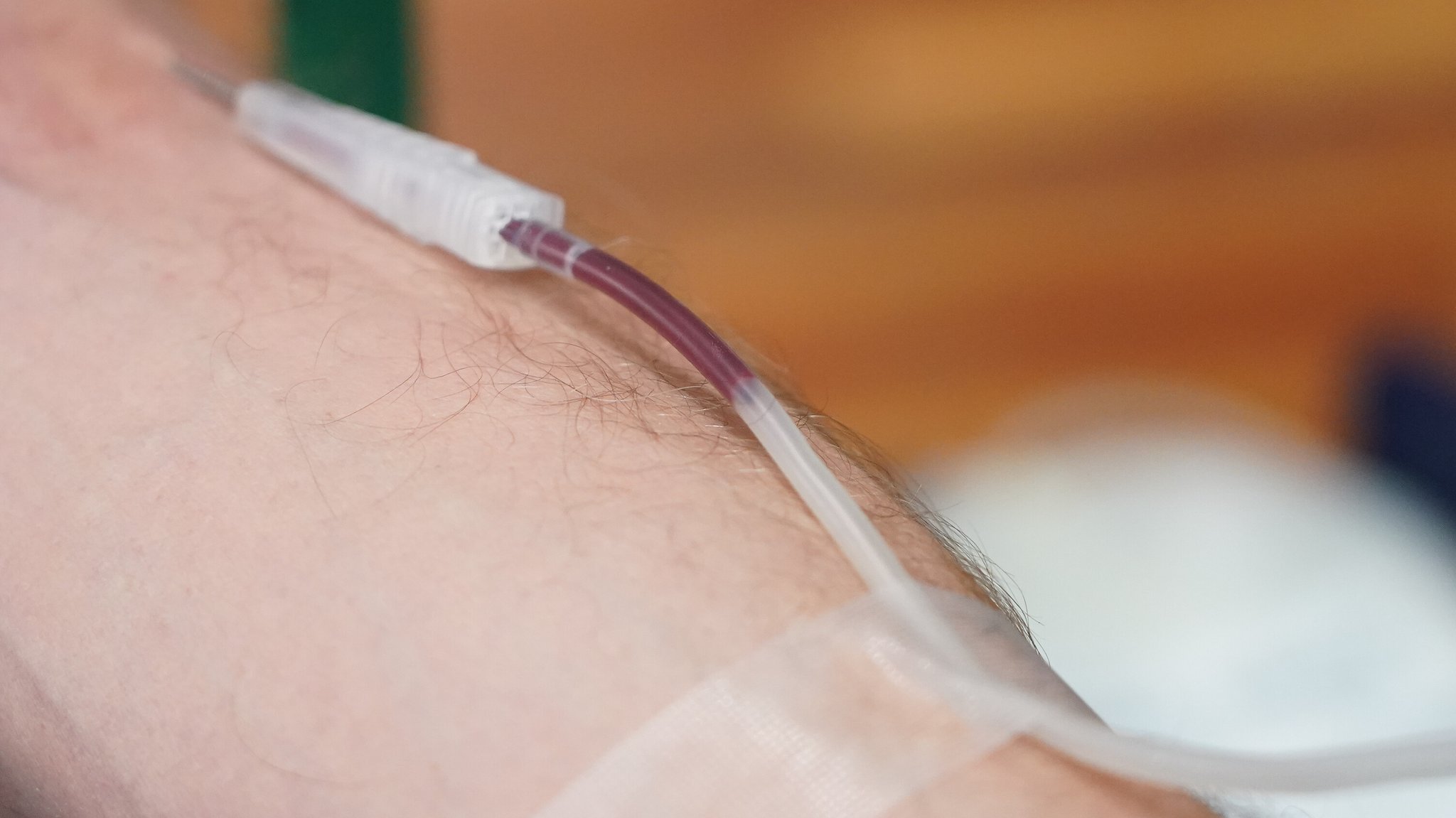 Die Nadel zur Blutspende ist gesetzt und Blut fließt in den Schlauch bei einer Blutspende in Groß-Gerau am 13.01.2026.