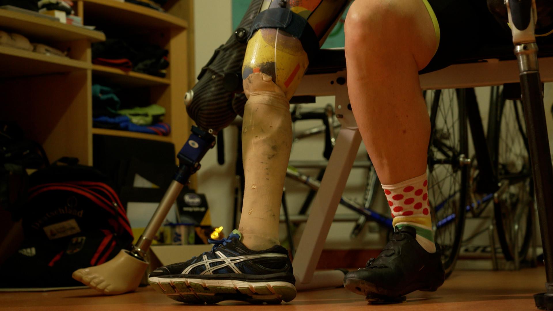 In Paris bei den Paralympics beweisen die Athleten täglich, welche Höchstleistungen sie vollbringen. Auch dank moderner Prothesen. Die werden immer passgenauer und spezialisierter, aber fördern auch den Breitensport - und den Alltag.