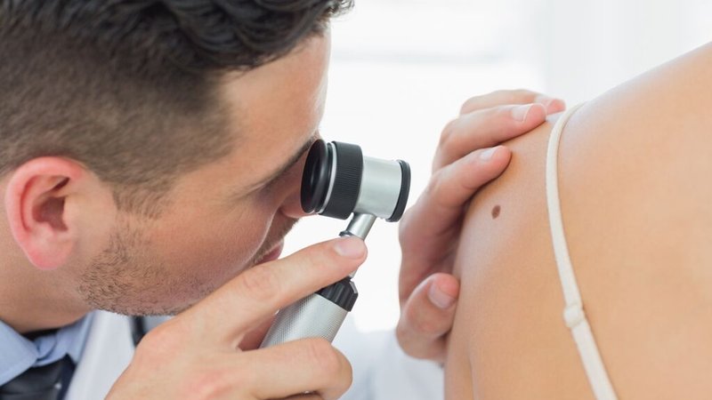Ein Dermatologe untersucht ein Muttermal auf der Haut einer Patientin. | Bild: stock.adobe.com/WavebreakmediaMicro Ein Dermatologe untersucht ein Muttermal auf der Haut einer Patientin.