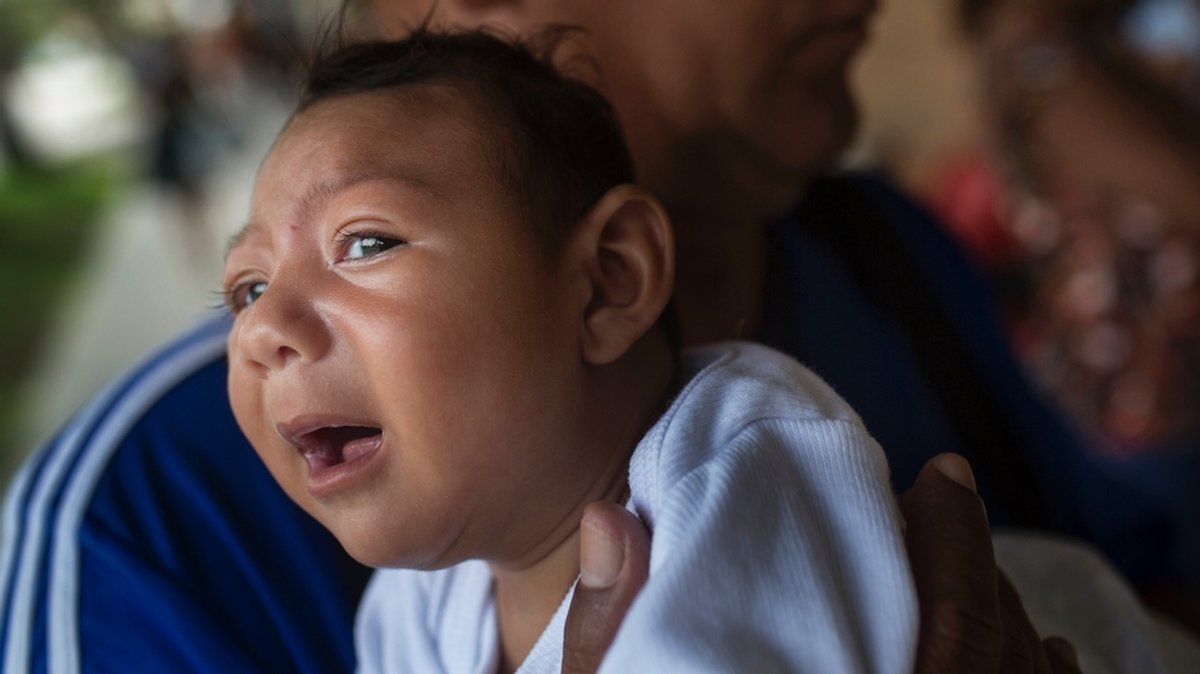 Zika-Virus und die Folgen: Ein Kind mit Mikrozephalie