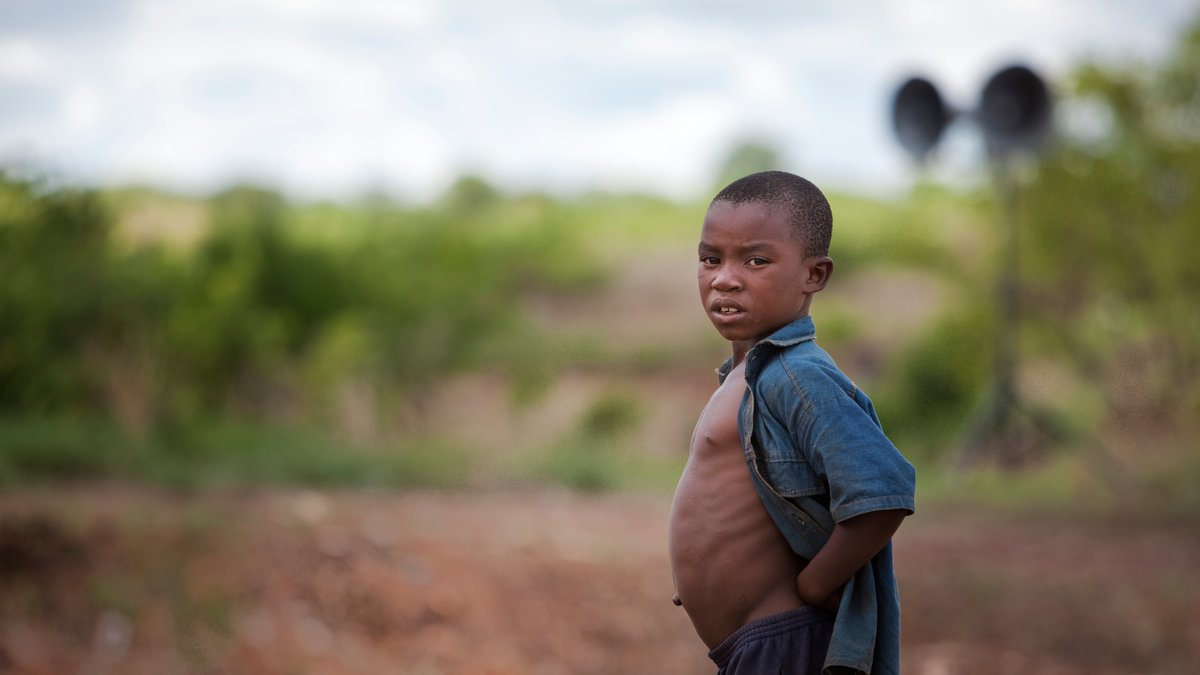 Junge mit Wasserbauch in Sambia