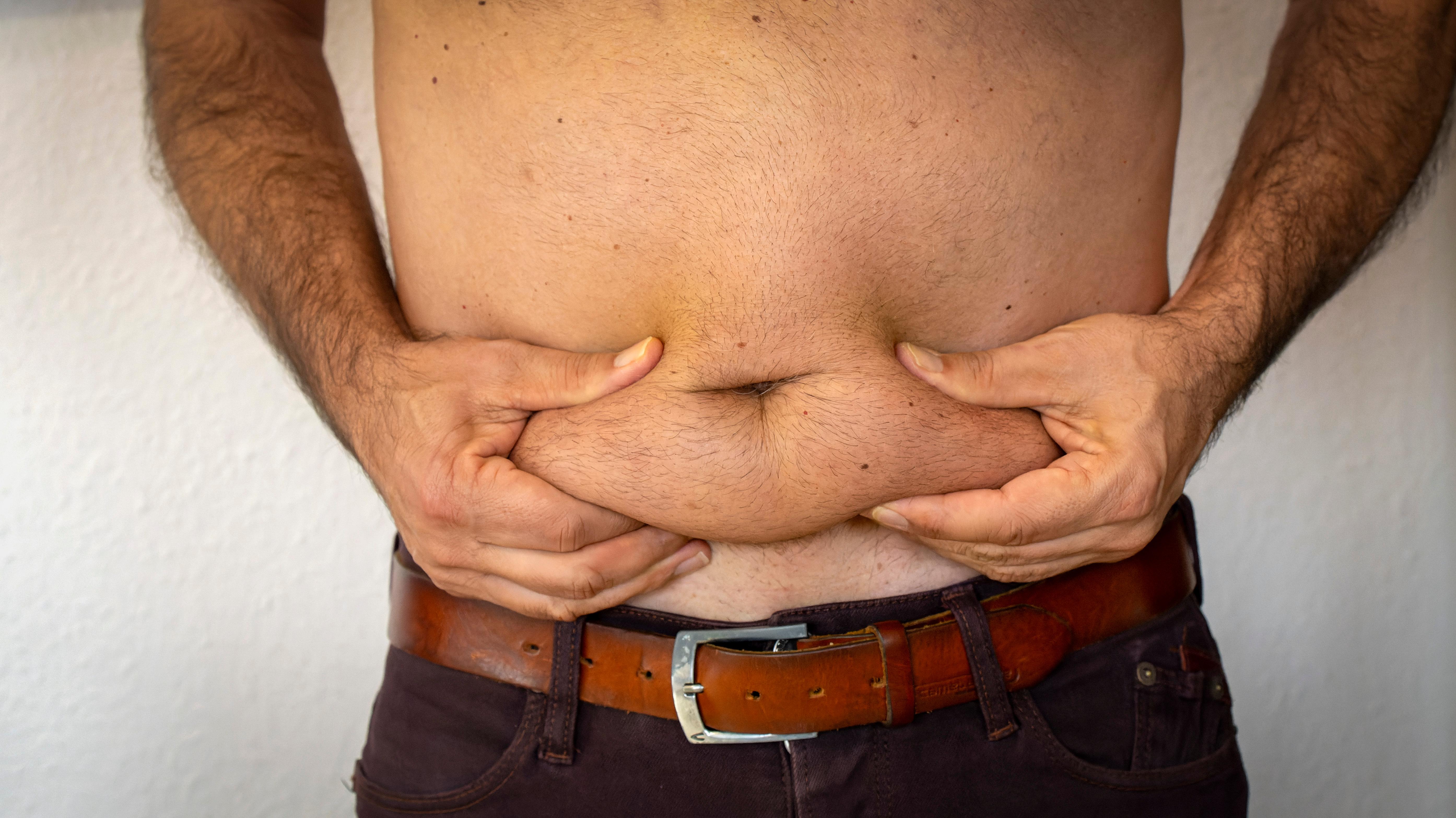 Ein Mann fasst mit beiden Händen seines Bauchs die Fettrolle