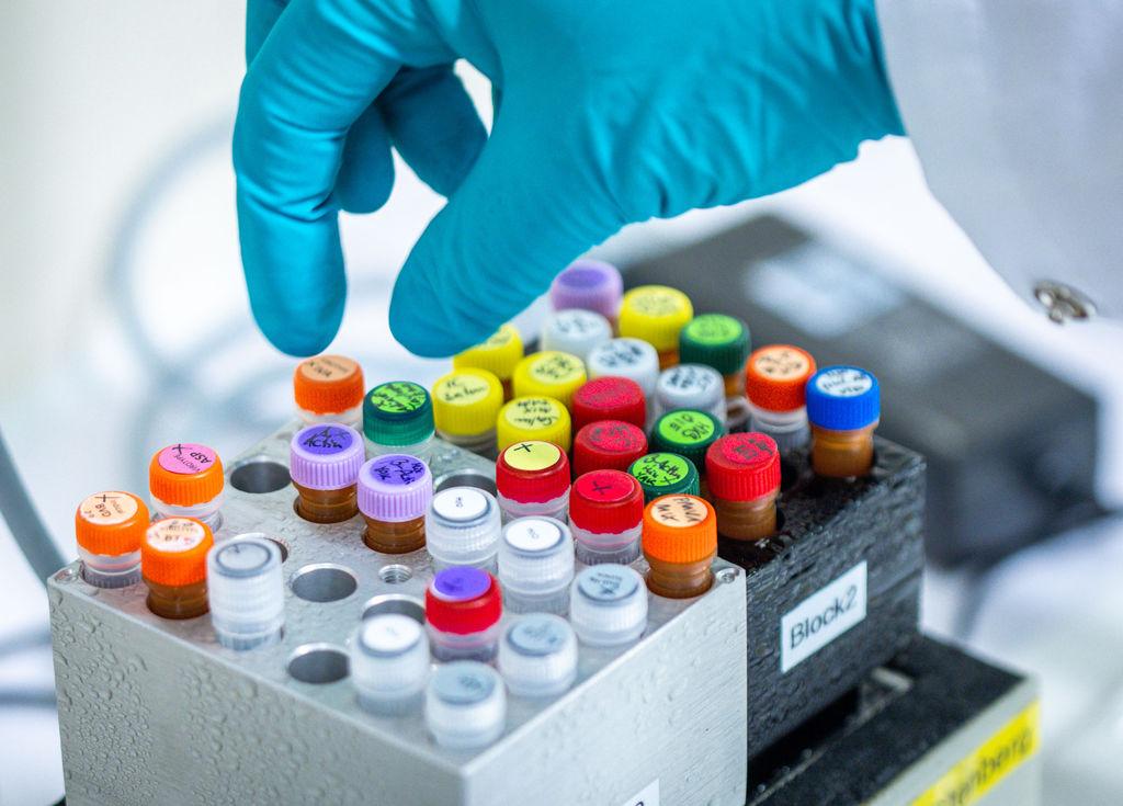 Unterschiedliche Substanzen stehen auf Kühlblöcken in einem sogenannten PCR Labor. (Archivbild)