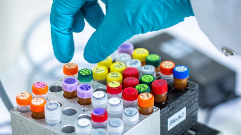 Unterschiedliche Substanzen stehen auf Kühlblöcken in einem sogenannten PCR Labor. (Archivbild) | Bild: dpa-Bildfunk/Jens Büttner Unterschiedliche Substanzen stehen auf Kühlblöcken in einem sogenannten PCR Labor. (Archivbild)