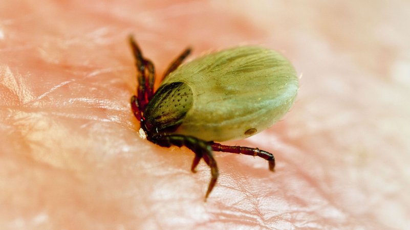 Eine Zecke, die sich in menschliche Haut bohrt | Bild: picture alliance imageBROKER Sommer, A. Eine Zecke, die sich in menschliche Haut bohrt