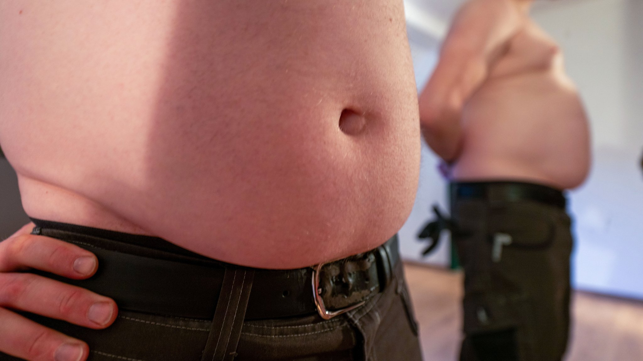 Fett ist nicht gleich Fett: Warum Bauchfett so gefährlich ist