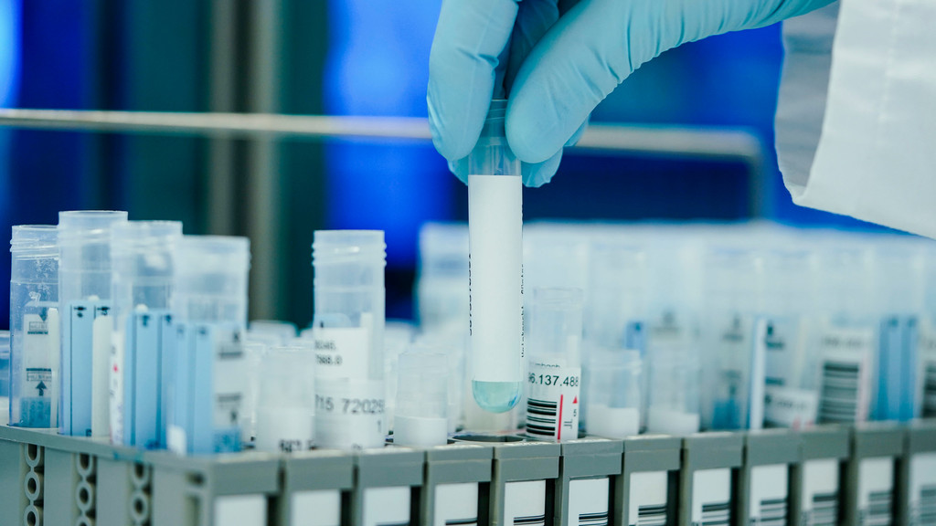 PCR-Tests werden in einem Labor untersucht.