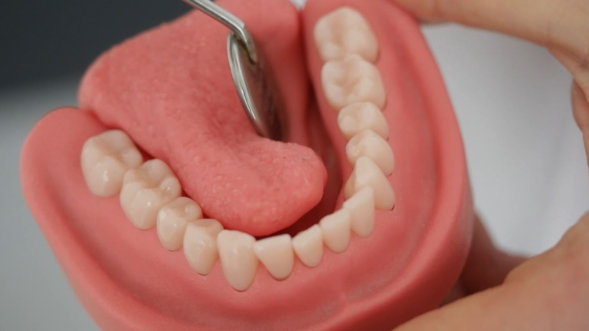 Zahngebiss aus dem 3D-Drucker