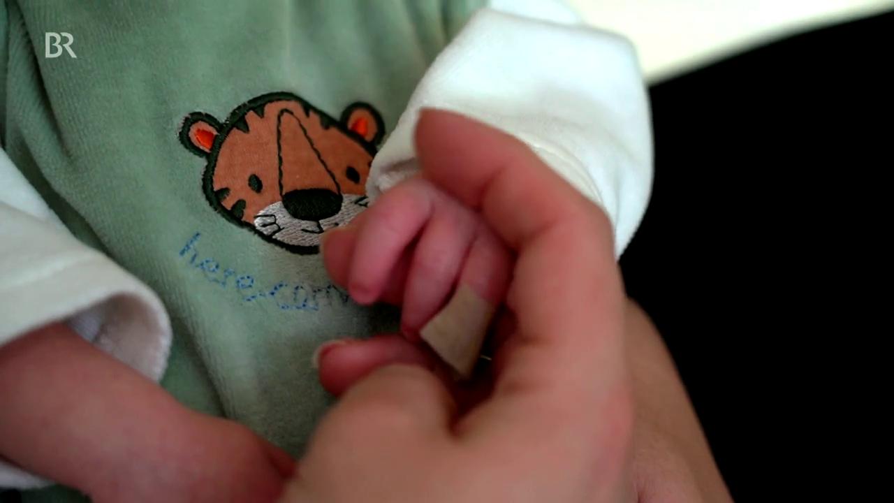 RS-Virus: Kinder können in Ausnahmefällen geimpft werden 