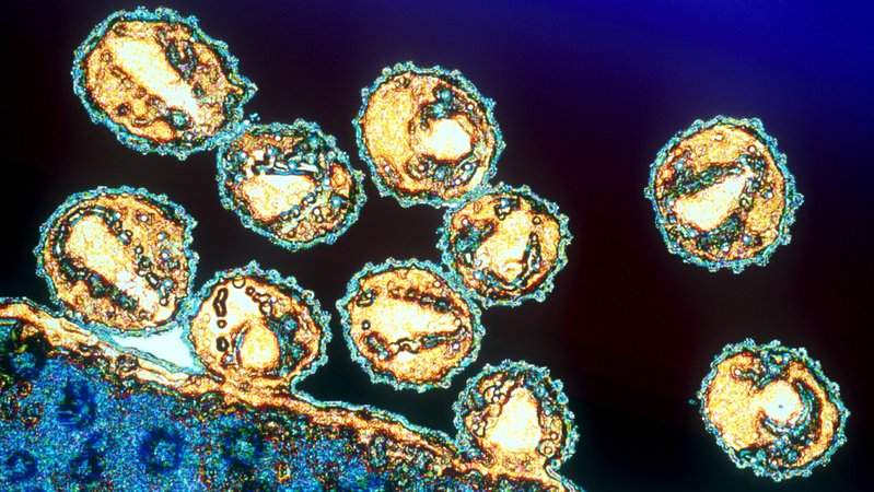 Mehrere HI-Viren im Blut. Sie können die Immunschwäche-Krankheit Aids auslösen.