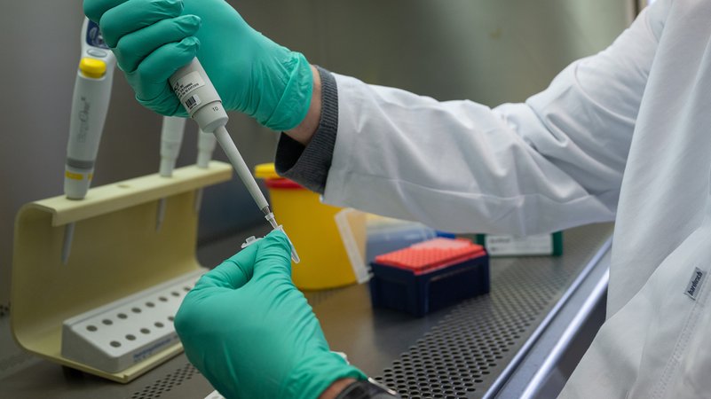 Ein Forscher zeigt im Landesgesundheitsamt Baden-Württemberg, wie ein PCR-Test für die Analyse auf Mutationen des Coronavirus vorbereitet wird. 