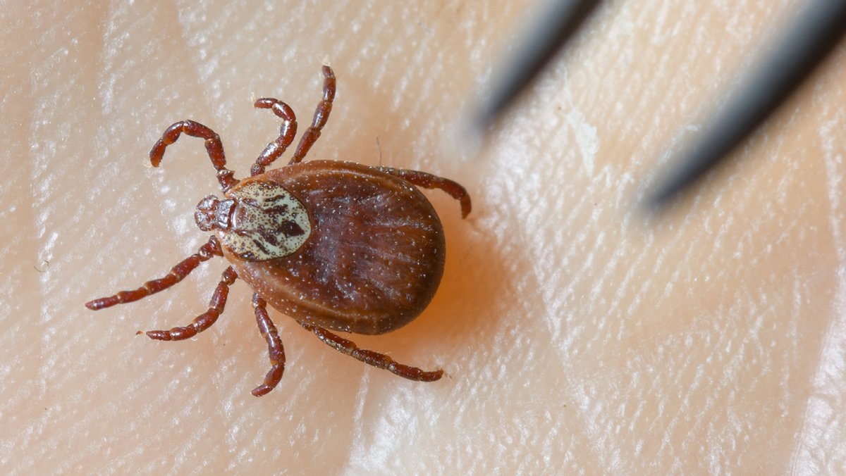 Borreliose nach Zeckenstich: Impfung soll kommen