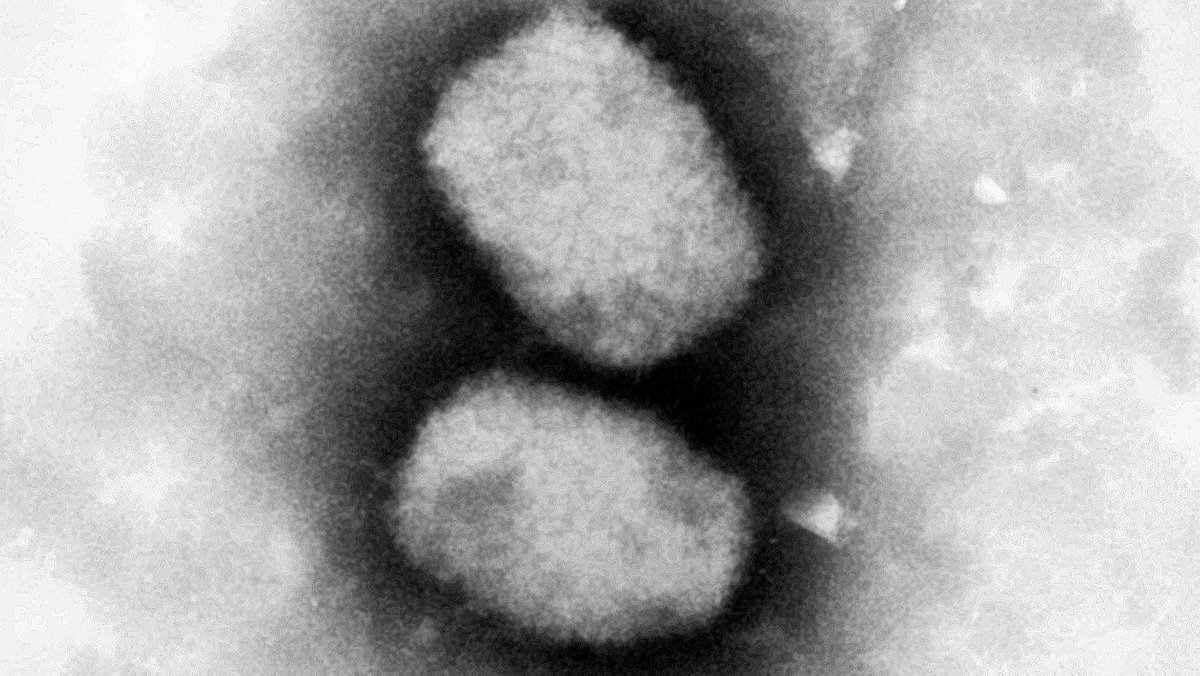 Diese vom RKI zur Verfügung gestellte elektronenmikroskopische Aufnahme zeigt das Affenpockenvirus. 