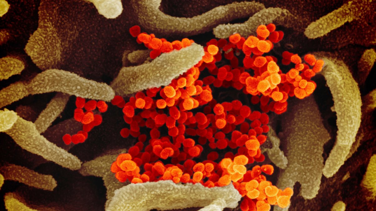 Eine elektronenmikroskopische Aufnahme zeigt das Coronavirus.