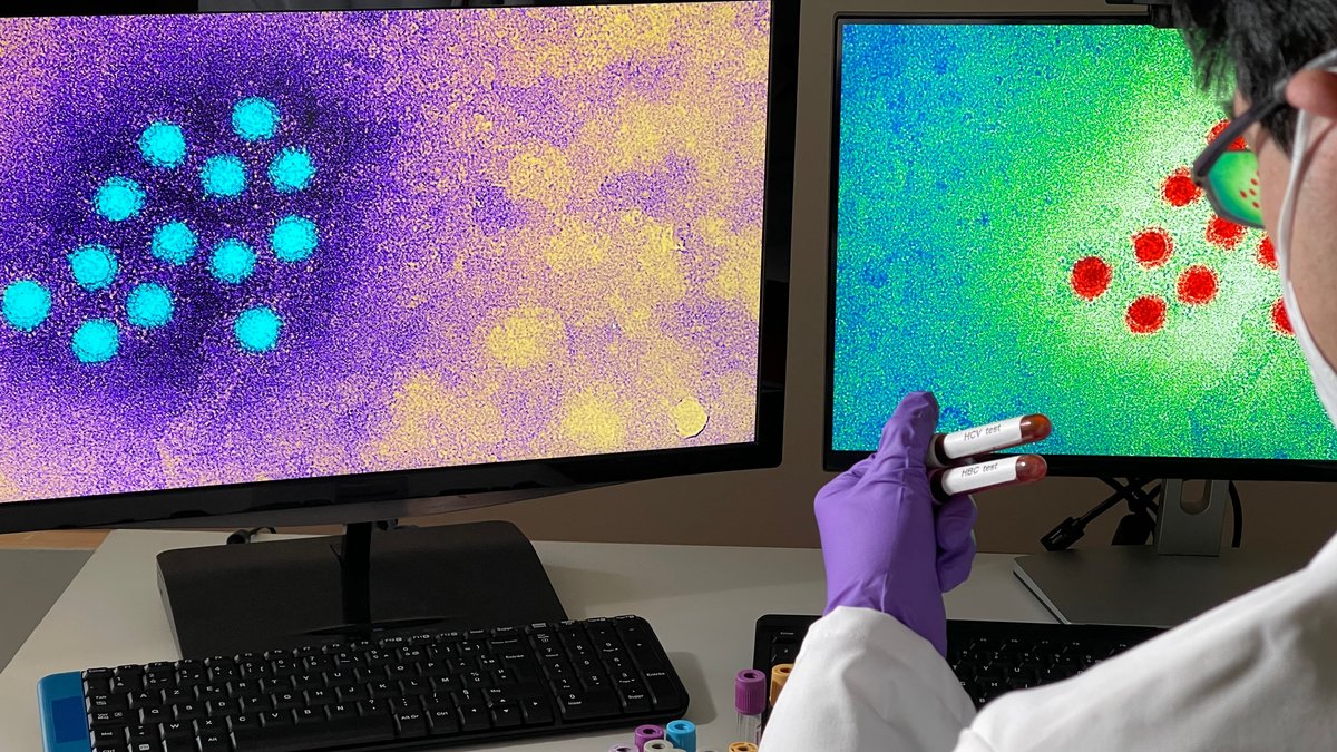 Hepatitis A: Impfung schützt vor der Reisegelbsucht