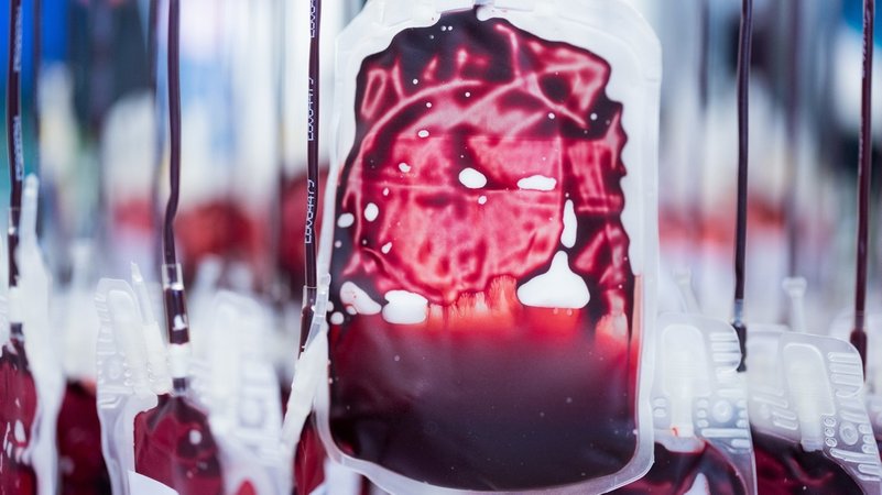 PRODUKTION - 15.02.2022, Nordrhein-Westfalen, Hagen: Blutkonserven werden im Zentrallabor des DRK-Blutspendedienstes für Krankenhäuser und Praxen gefiltert und aufbereitet. Im nordrhein-westfälischen Gelsenkirchen fand am 29. Februar 1952 der wohl bundesweit erste offizielle Blutspendetermin des Deutschen Roten Kreuzes statt. (Zu dpa: "Grubenunglück als Startsignal - 70 Jahre Blutspenden in Deutschland" - Wiederholung vom 22.02.2022) Foto: Rolf Vennenbernd/dpa +++ dpa-Bildfunk +++ | Bild: dpa-Bildfunk/Rolf Vennenbernd PRODUKTION - 15.02.2022, Nordrhein-Westfalen, Hagen: Blutkonserven werden im Zentrallabor des DRK-Blutspendedienstes für Krankenhäuser und Praxen gefiltert und aufbereitet. Im nordrhein-westfälischen Gelsenkirchen fand am 29. Februar 1952 der wohl bundesweit erste offizielle Blutspendetermin des Deutschen Roten Kreuzes statt. (Zu dpa: "Grubenunglück als Startsignal - 70 Jahre Blutspenden in Deutschland" - Wiederholung vom 22.02.2022) Foto: Rolf Vennenbernd/dpa +++ dpa-Bildfunk +++