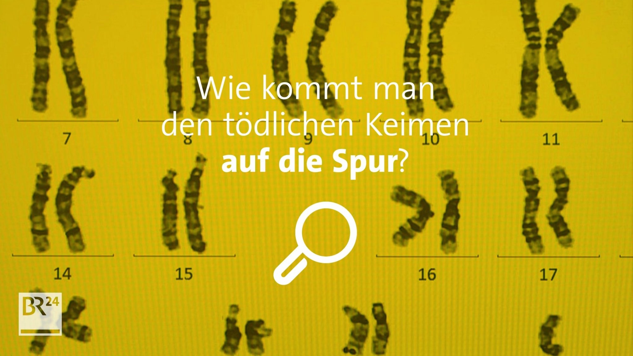 Wie kommt man den tödlichen Keimen auf die Spur?