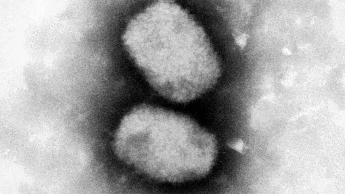 Diese vom Robert Koch-Institut (RKI) zur Verfügung gestellte elektronenmikroskopische Aufnahme zeigt das Affenpockenvirus. 