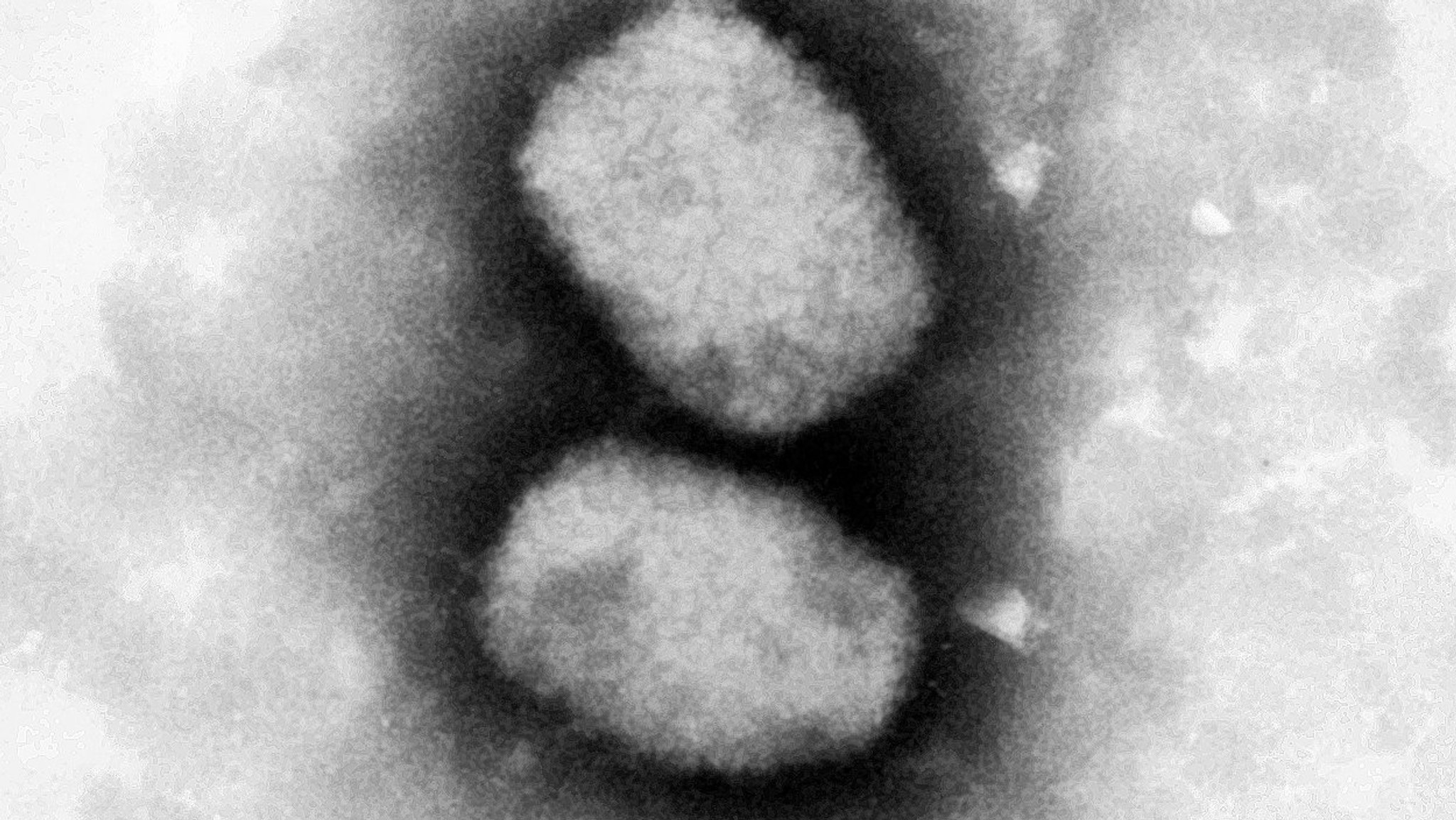 Diese vom Robert Koch-Institut (RKI) zur Verfügung gestellte elektronenmikroskopische Aufnahme zeigt das Affenpockenvirus. 