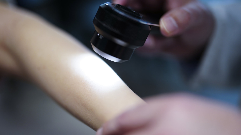 Ein Hautarzt untersucht bei einer Krebsvorsorgeuntersuchung eine Patientin mit einem Auflichtmikroskop. 