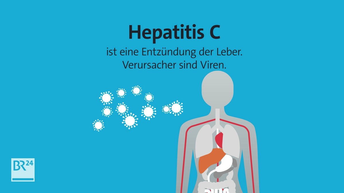 #fragBR24💡 Was ist eigentlich Hepatitis C?