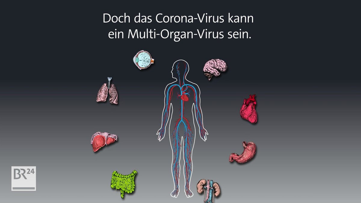 Das Coronavirus kann nicht nur eine schwere Lungenentzündung hervorrufen, sondern auch andere Organe des Körpers attackieren.