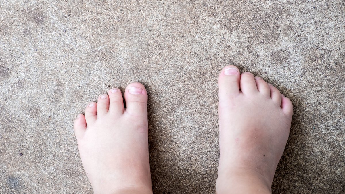 Die nackten Füße eines Kinder auf Beton. (Symbolbild)