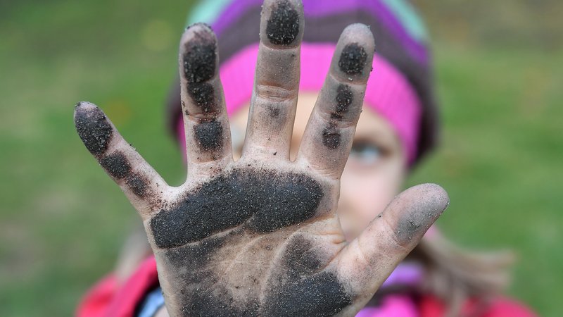 Die Konfrontation mit Keimen schützt vor Allergien, zu viel Reinheit kann Allergien hervorrufen. Forscher stellen diese Hygienehypothese in Frage. Im Bild: Ein Mädchen zeigt ihre schmutzigen Hände nach dem Spielen im Erdboden.
