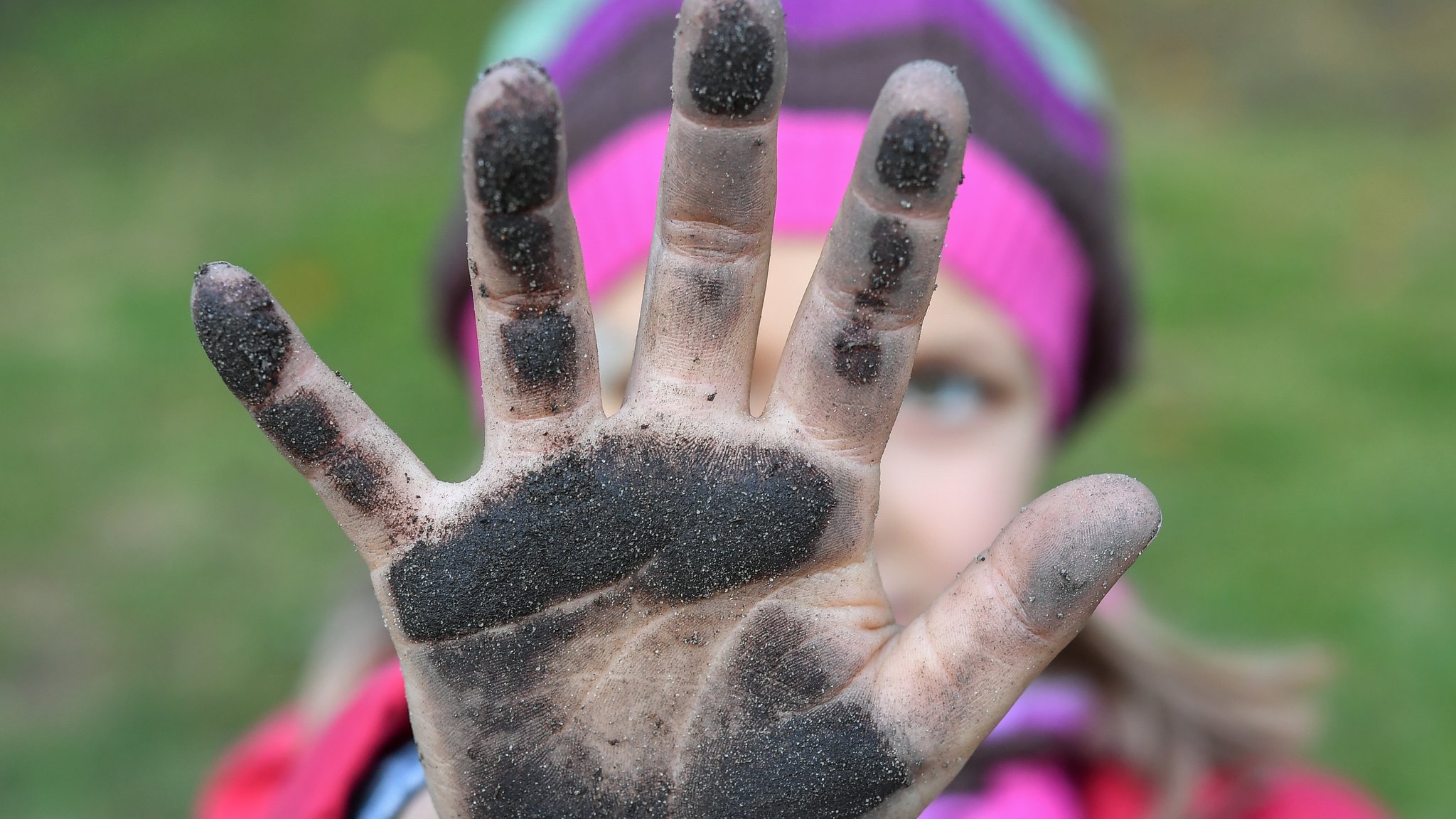 Die Konfrontation mit Keimen schützt vor Allergien, zu viel Reinheit kann Allergien hervorrufen. Forscher stellen diese Hygienehypothese in Frage. Im Bild: Ein Mädchen zeigt ihre schmutzigen Hände nach dem Spielen im Erdboden.