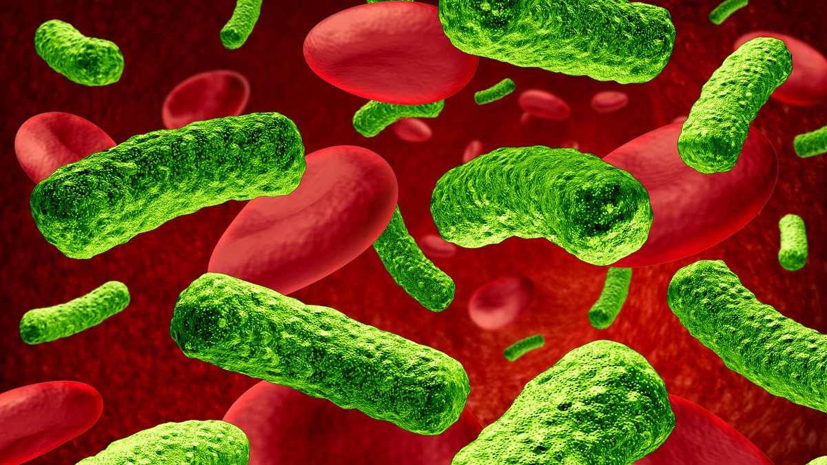 Blutvergiftung: Sepsis, eine lebensbedrohliche Erkrankung