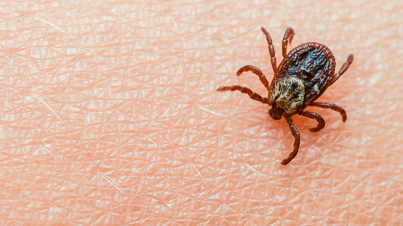 Nahaufnahme: Zecke krabbelt über den Arm eines Kindes | Bild: picture alliance / Patrick Pleul/dpa-Zentralbild/ZB | Patrick Pleul Nahaufnahme: Zecke krabbelt über den Arm eines Kindes