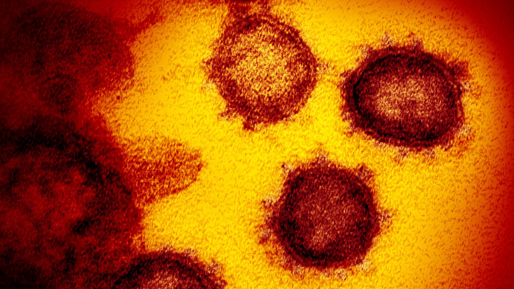 SARS-CoV-2, das neue Coronavirus