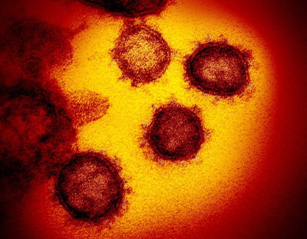 SARS-CoV-2, das neue Coronavirus