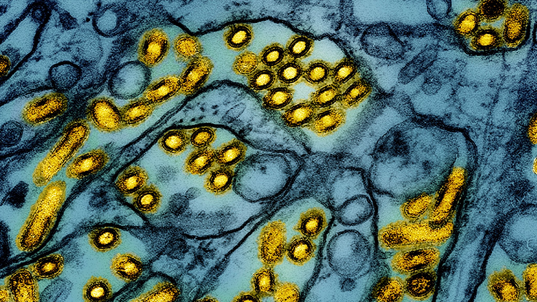 Kolorierte Elektronenmikroskop-Aufnahme von Vogelgrippe-Virus-Partikeln H5N1