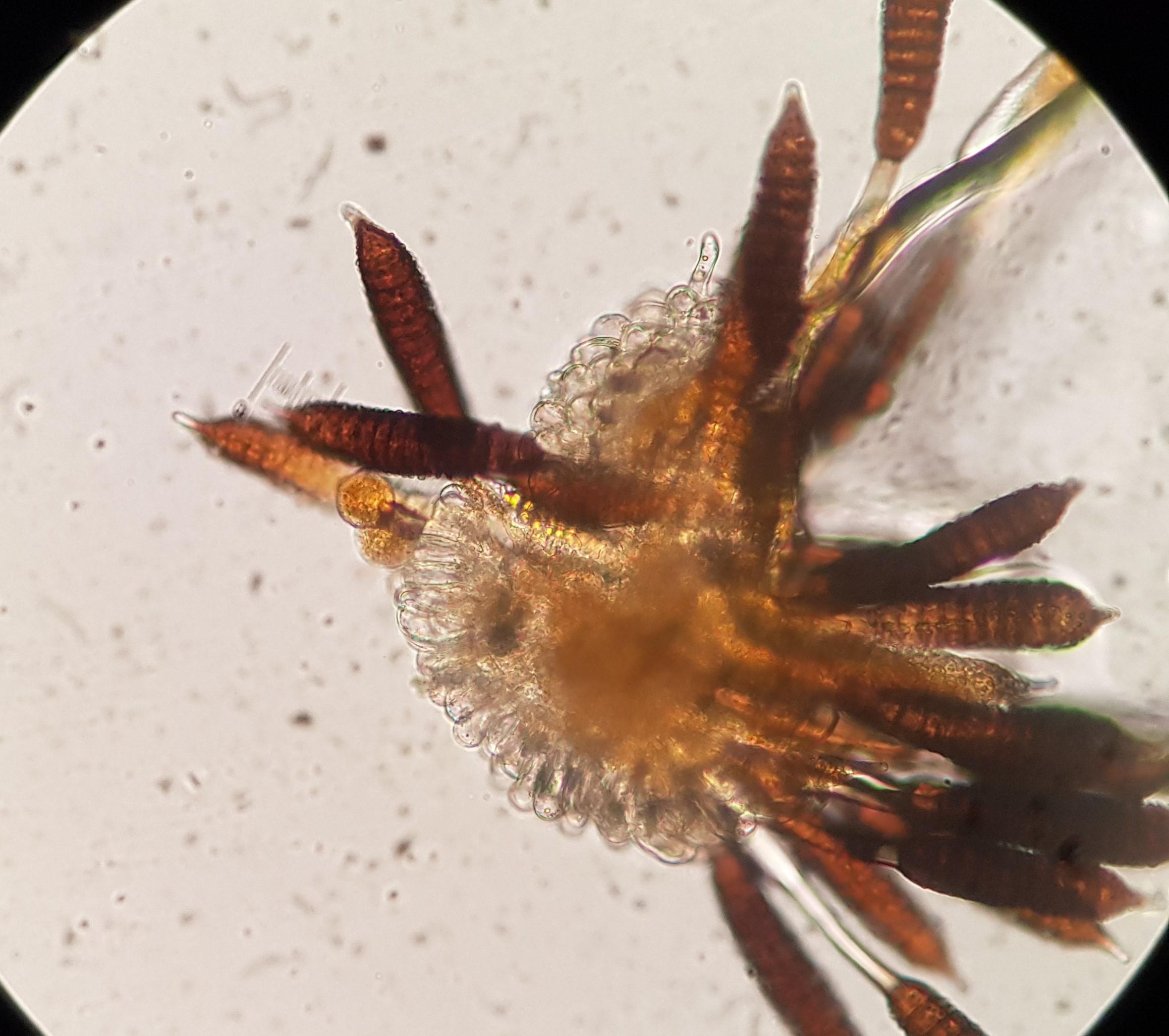 Neue Pilzart | Bild:BR