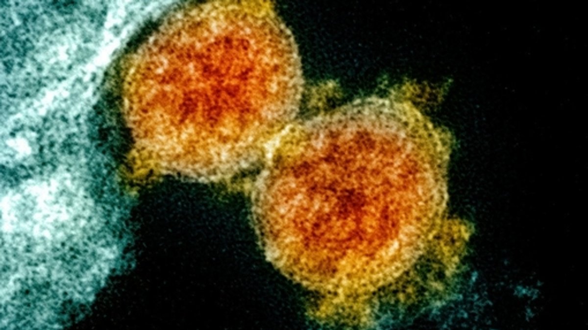 Coronavirus - Mikroskopische Aufnahme