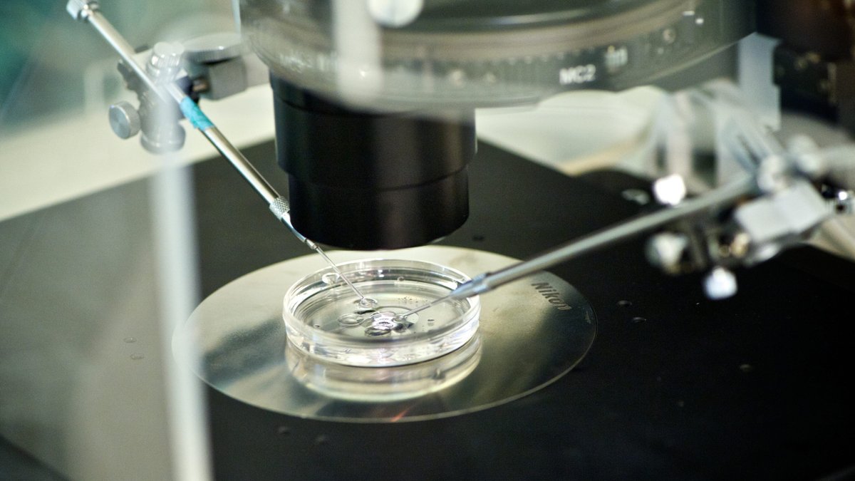 Unter einem Mikroskop sieht man ein Glas mit medizinischer Gerätschaft und Eizellen; In-vitro-Fertilisation; Embryobiopsie im Biologielabor.