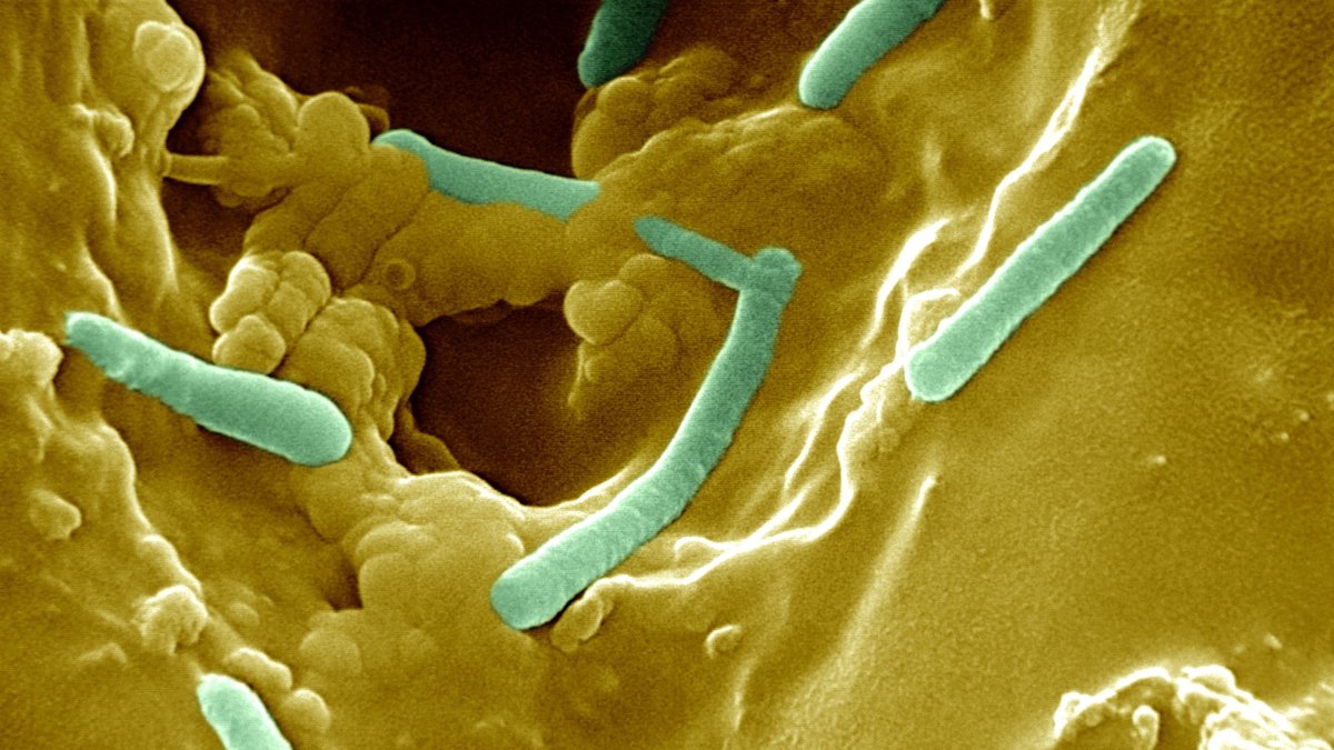 Pseudomonas aeruginosa ist ein Bakterium, das unter dem Mikroskop wie ein kleines Stäbchen aussieht. 