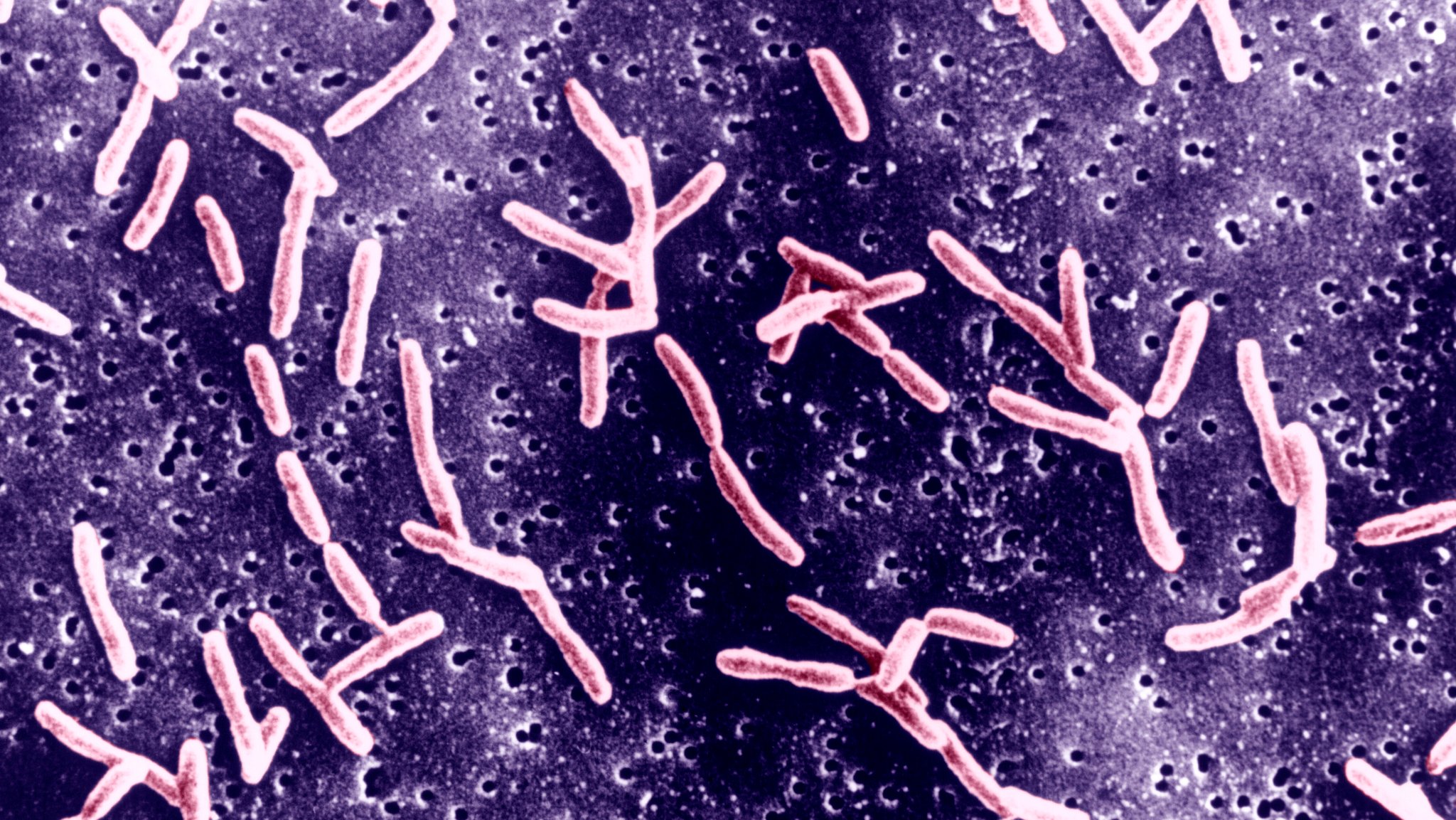 Campylobacter jejuni in 6.000-facher Vergrößerung eines Elektronenmikroskops