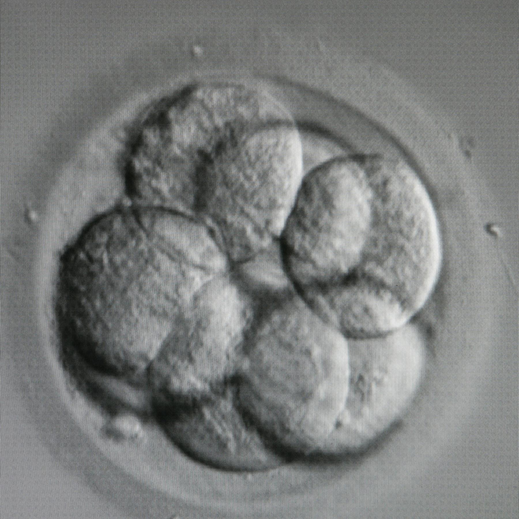 Der Umgang mit Embryo-Modellen - Zwischen Forschung, Recht und Ethik