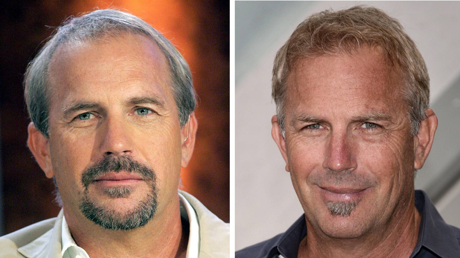 Christoph Metzelder Hat Jetzt Volleres Haar Haartransplantation Diese Promis Haben Die Frisur Getuned Bayern 3